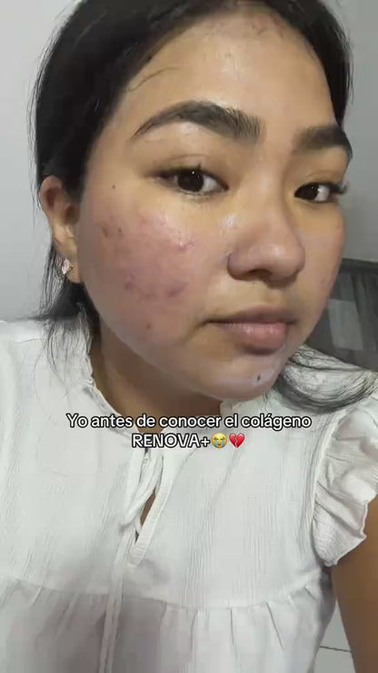 COLÁGENO RENÖVA+